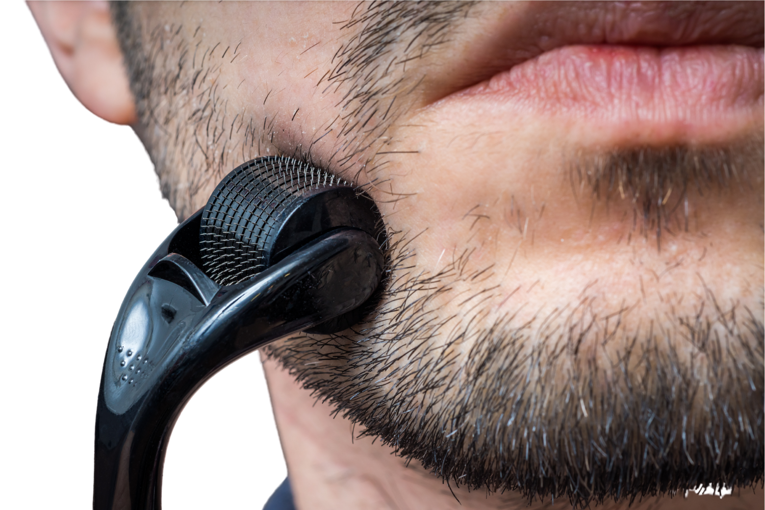 The Five Best Beard Derma Rollers (for When You're Feeling Scruffy)